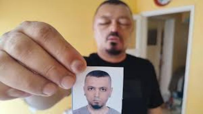 Adana’da Saç Boyası Kabusu: Şampuan Yüzünden Gözleri Şişti, Kafasında Yaralar Oluştu