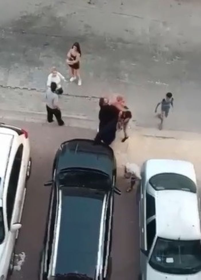 Bacağından alınan dokuyla yeni yüzüne kavuştu